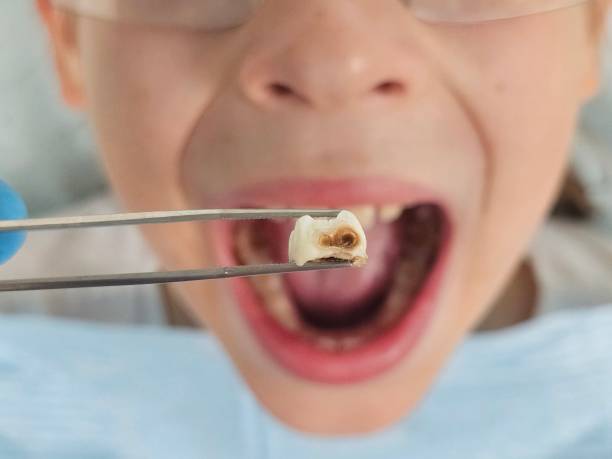 Best Weekend Emergency Dentist in Crab Orchard, WV