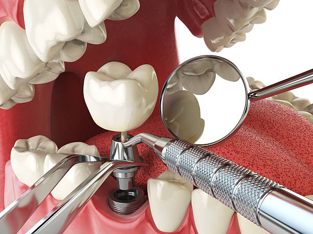 Best Emergency Root Canal Treatment in Crab Orchard, WV